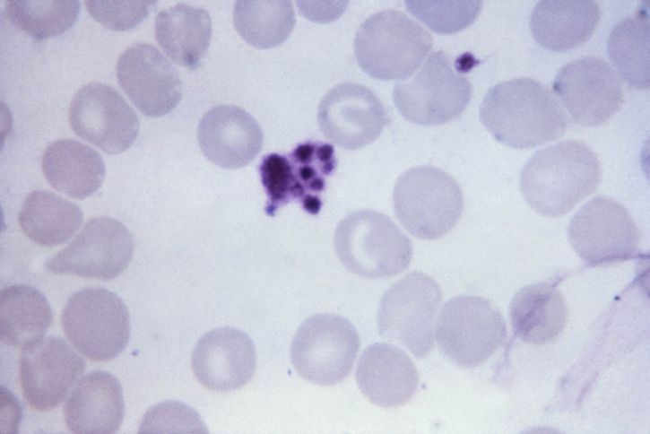 micrographie, plaquettes, artefact, confondu, le paludisme, un parasite