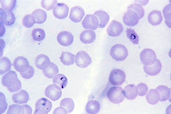 トロフォゾイト、熱帯熱マラリア原虫フォーム リング顕微鏡写真