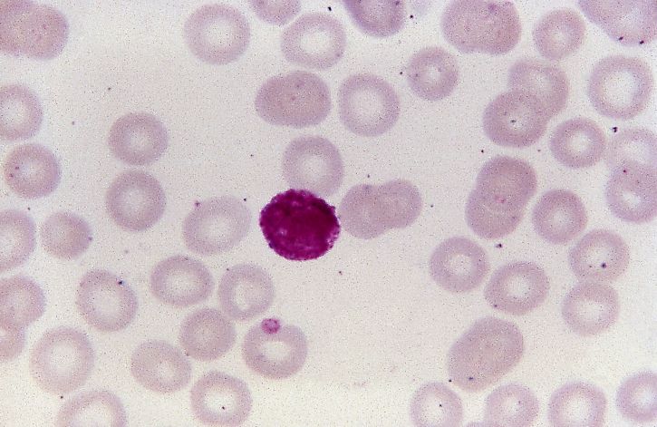 micrograph, non, vivax, màu đỏ, microgametocyte, phóng đại, 1125 x