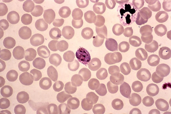 Imagem Gratuita Micrografia Madura Vivax Do Plasmodium Schizont