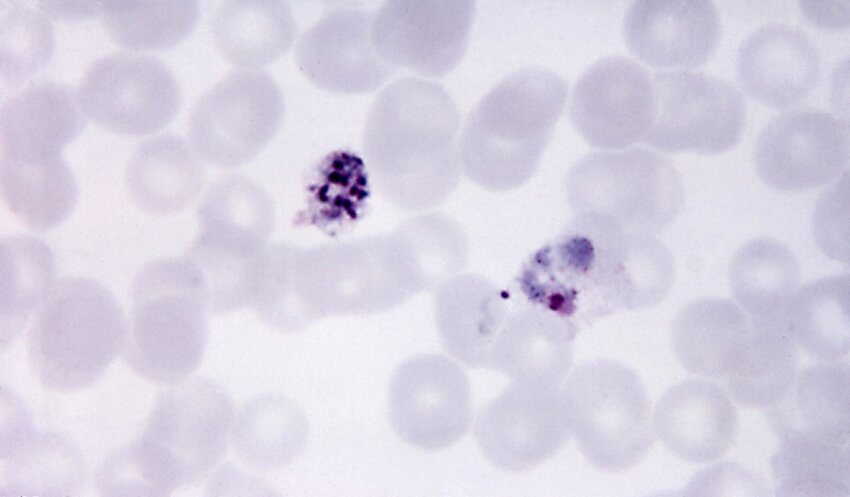 Free Picture Micrograph Immature Plasmodium Vivax Schizont Old Trophozoite Mag X