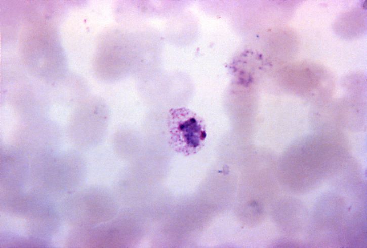 μικρογραφία, ανώριμο, plasmodium vivax, schizont, τρεις, χρωματίνη, μάζες, mag, 1125 x