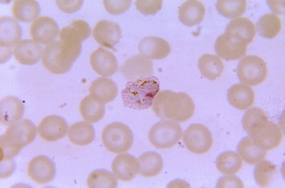 显微图像, 老, 变形, 间日疟原虫, 滋养体, 显示, 明显, 色素, 细胞质
