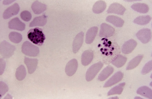 顕微鏡写真、成熟、未成熟、三日熱マラリア原虫、シゾント