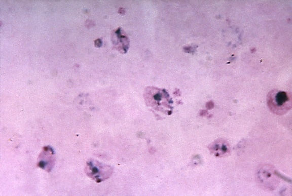 micrographie, croissant, amiboïde, vivax, trophozoites, magnifiés, 1125x