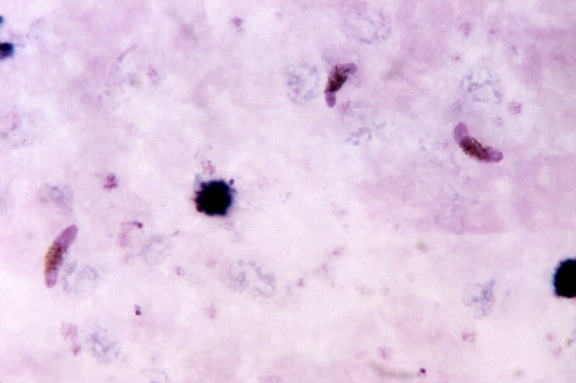 micrograph, three, pinkish, colored, crescent, shaped, plasmodium falciparum, gametocytes
