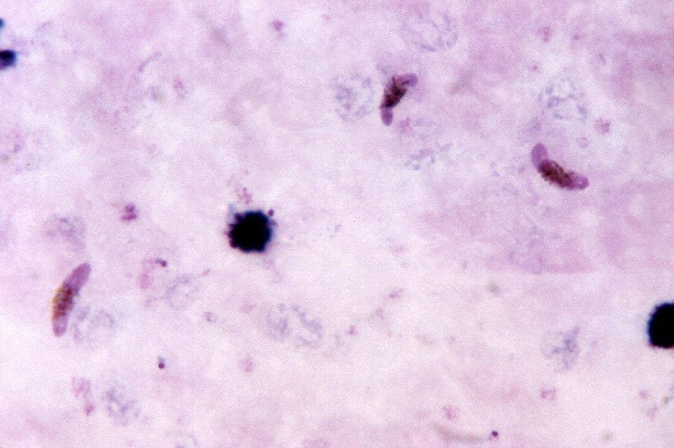 Kostenlose Bild Mikroskopische Aufnahme Reif Plasmodium Vivax Schizont Merozoiten