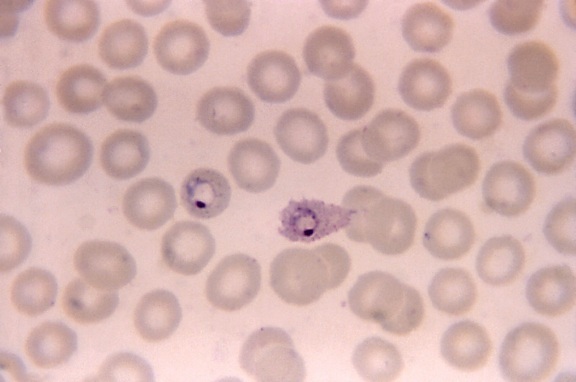micrograph, two, ovale, ring, form, trophozoites, one, one, oval