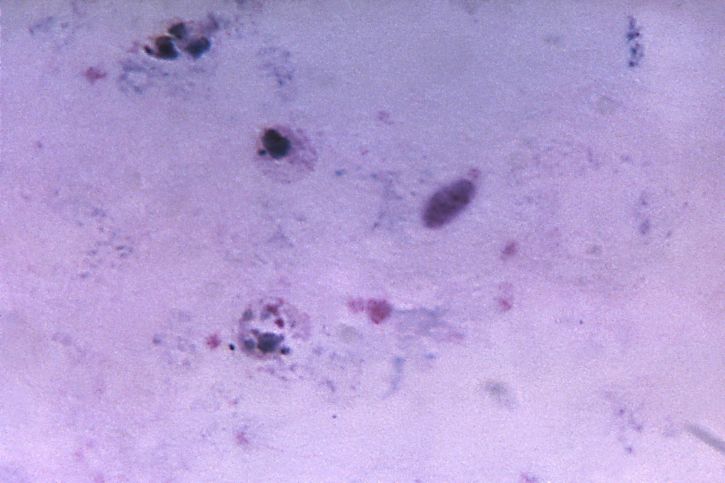 Mikrograf, två, vivax, trophozoites, smält, trombocyter, förstorad, 1125 x