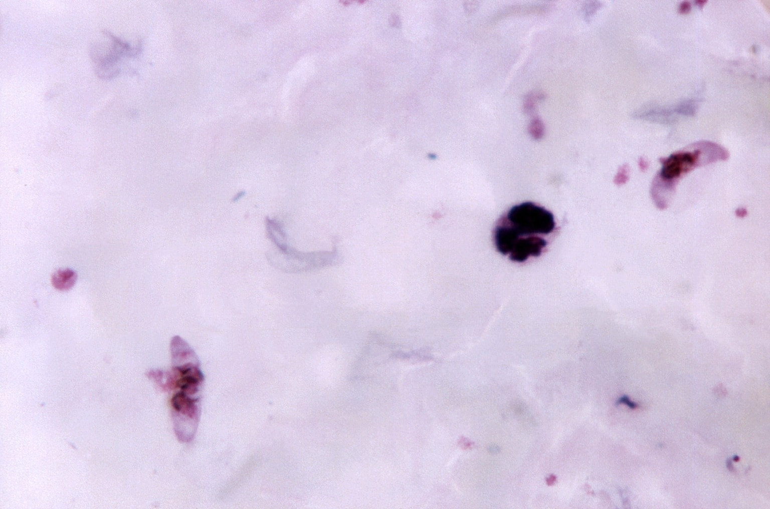 Kostenlose Bild Mikroskopische Aufnahme Reif Plasmodium Vivax Schizont Merozoiten