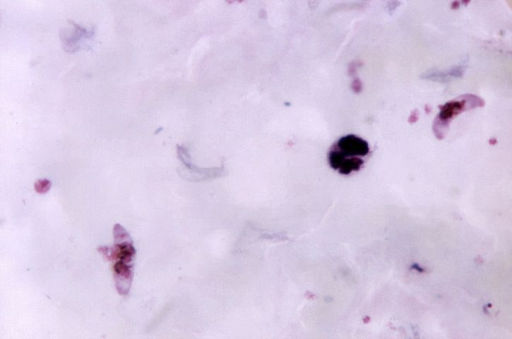 micrograph, two, pinkish, colored, crescent, shaped, plasmodium falciparum, gametocytes