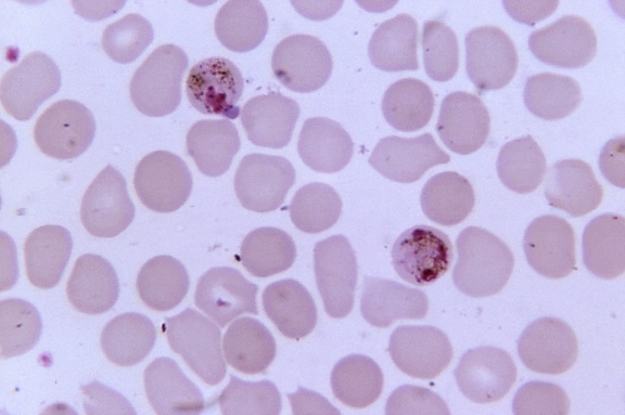 microfotografia, due, plasmodium malariae, schizonti