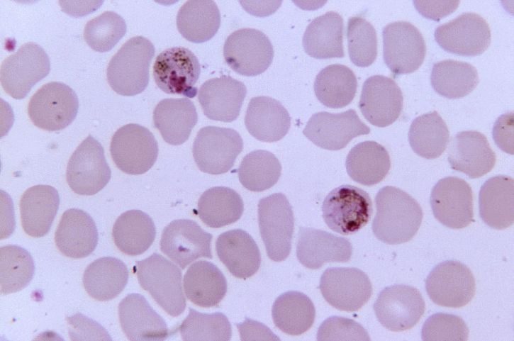 micrographie, deux, plasmodium malariae, schizontes