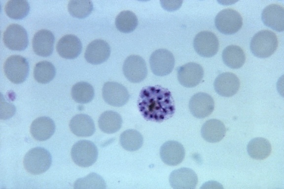 micrograph, mature, plasmodium vivax, schizont, merozoites, mag, 1125x