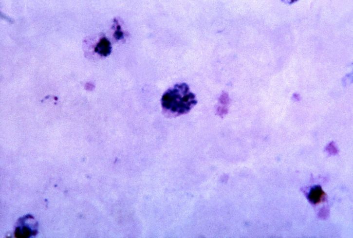 顕微鏡写真、成熟、三日熱マラリア原虫、シゾント、拡大、メロゾイト 1125 x