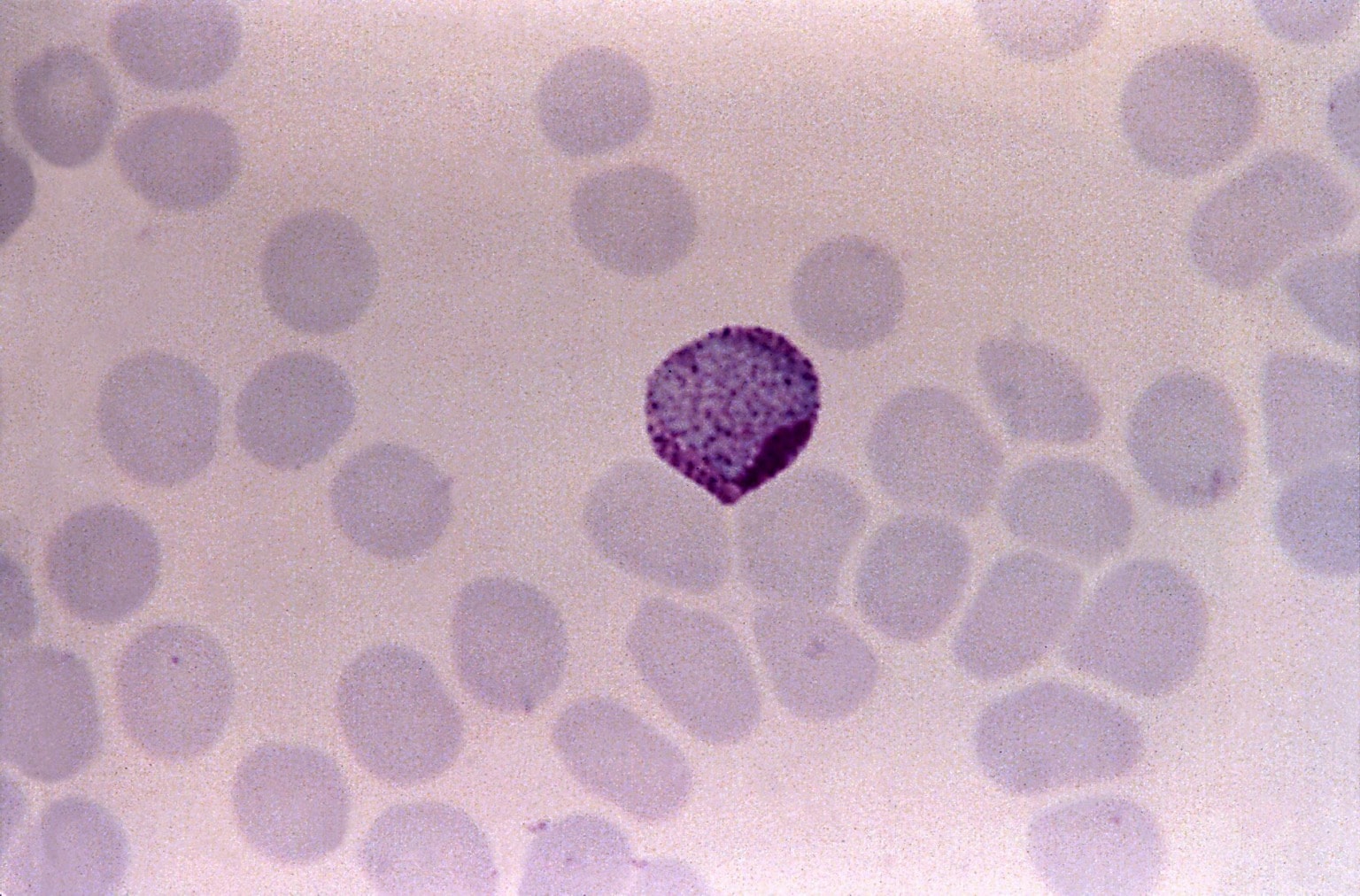 Антитела к saccharomyces cerevisiae. Плазмодий Вивакс. Микроскопия Плазмодиум Вивакс. Плазмодий микрофотография. Токсоплазма шизонт.