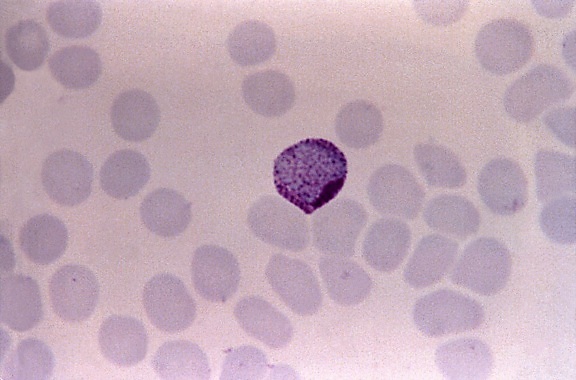Micrografia, vivax do plasmodium, macrogametocyte, distintas, schufners, pontos, mag, 1125 x