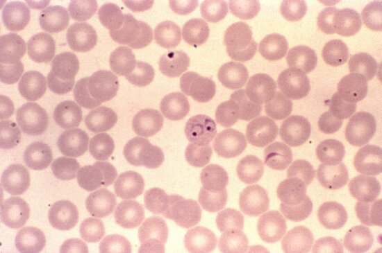 Kostenlose Bild Blutausstrich Mikroskopische Aufnahme Plasmodium Falciparum Parasit