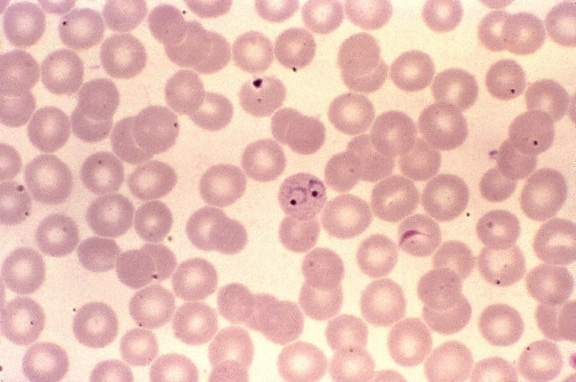 顕微鏡写真、1 つ、2 つ、リング、フォーム、三日熱マラリア原虫、栄養型