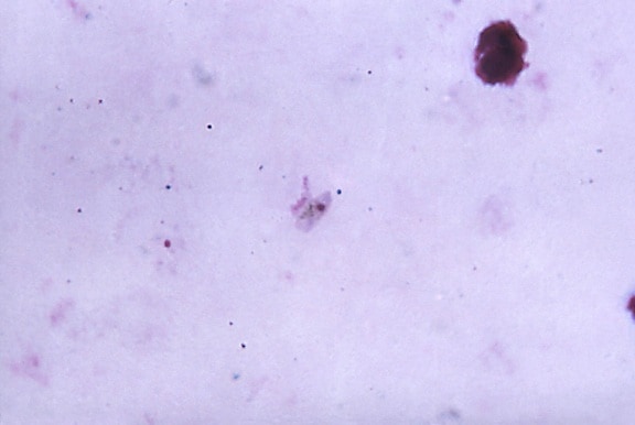 micrograph, elongated, lightly, pink, plasmodium falciparum, gametocyte