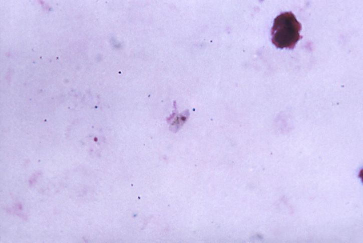 显微图像, 拉长, 轻度, 粉红色, 恶性疟原虫, gametocyte