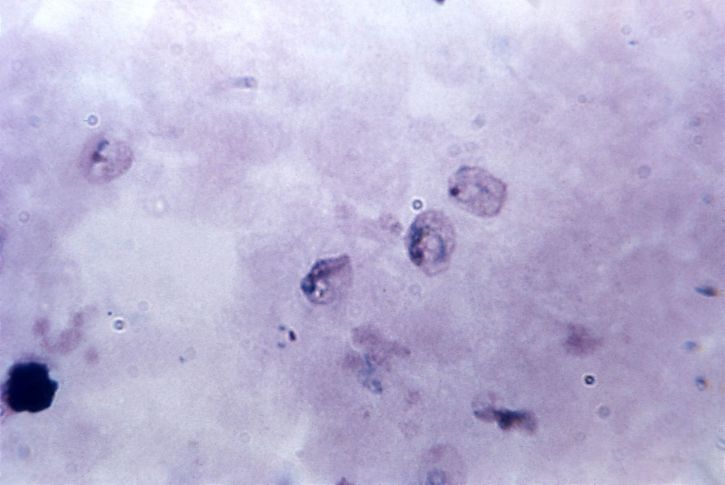 micrograph, growing, plasmodium trophozoites, schuffners, dot, stippling, clearly, defined