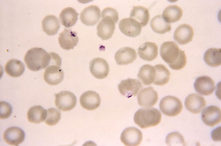 mikroskopische Aufnahme, zwei, falciparum, Ringe, Maurers, punkte, gekerbt, rot, Blut, Zellen