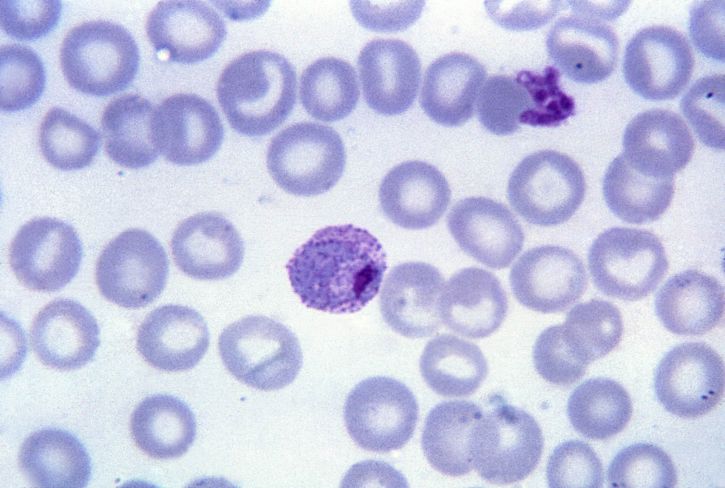 顕微鏡写真、成熟、三日熱マラリア原虫、トロフォゾイト