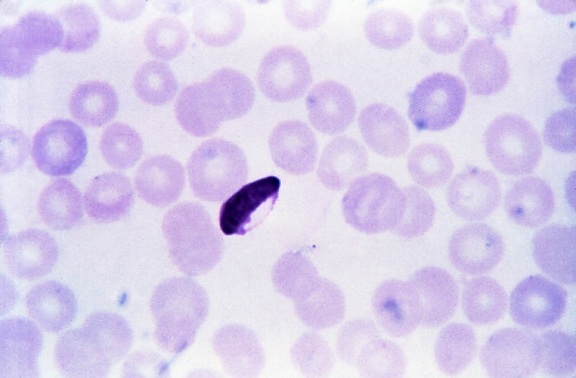 mikroskopische Aufnahme, Plasmodium falciparum microgametocyte