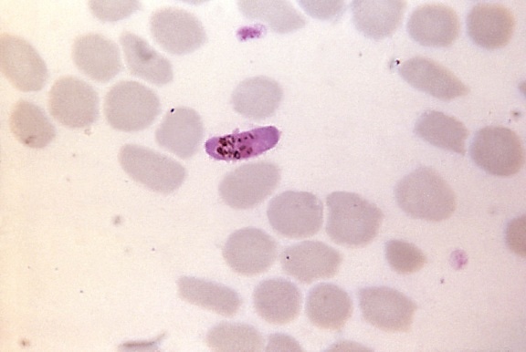 micrografía, de color rojizo, color, plasmodium falciparum, microgametocito, distinto, pigmento