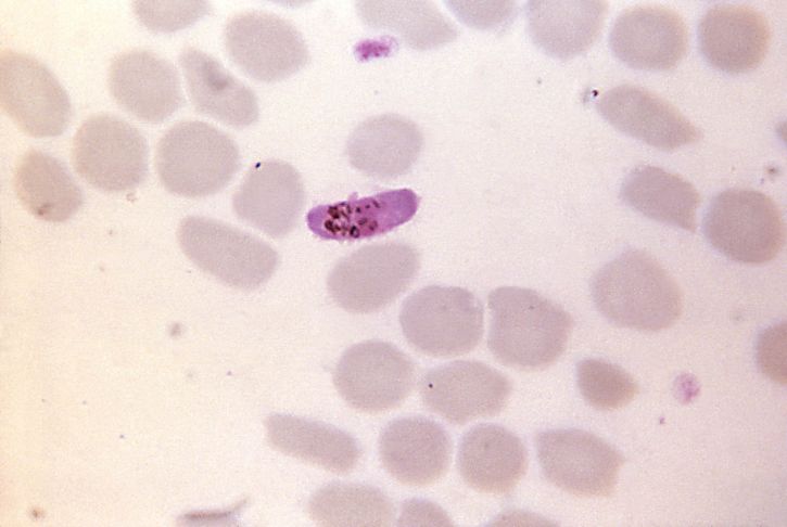 Mikrograf, rödaktig, färgade, Plasmodiumfalciparum microgametocyte, distinkt, pigment