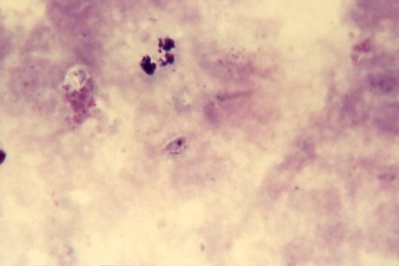 micrograph, artifact, mold, resembling, falciparum, gametocyte