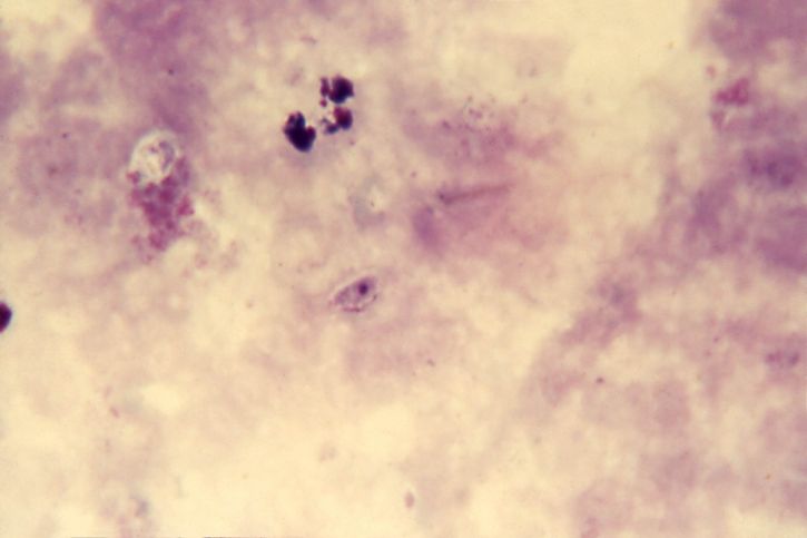 Mikrograf, artefakt, skimmel, der ligner, falciparum, gametocyte