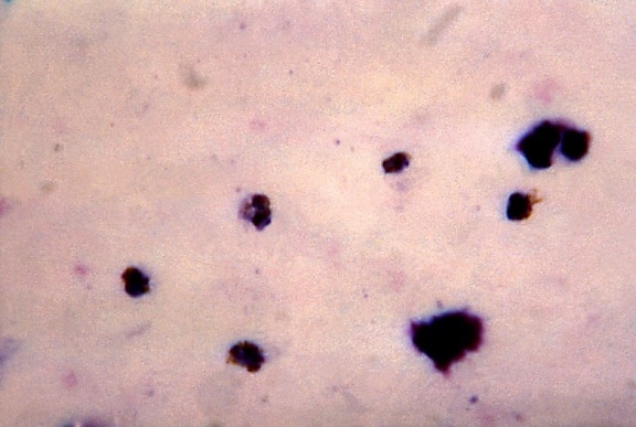 현미경 사진, 5, 나이, 성장, 변형 체 malariae trophozoites