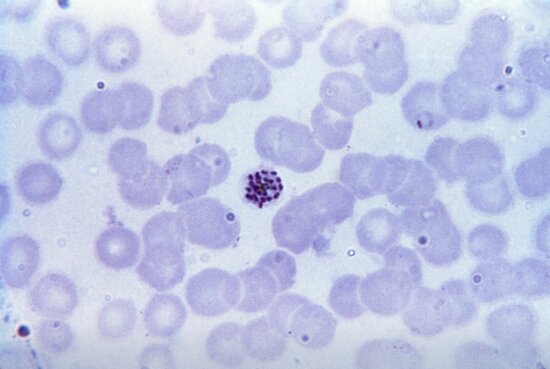 Imagen gratis frotis de sangre micrografía Plasmodium falciparum parásito microgametocito