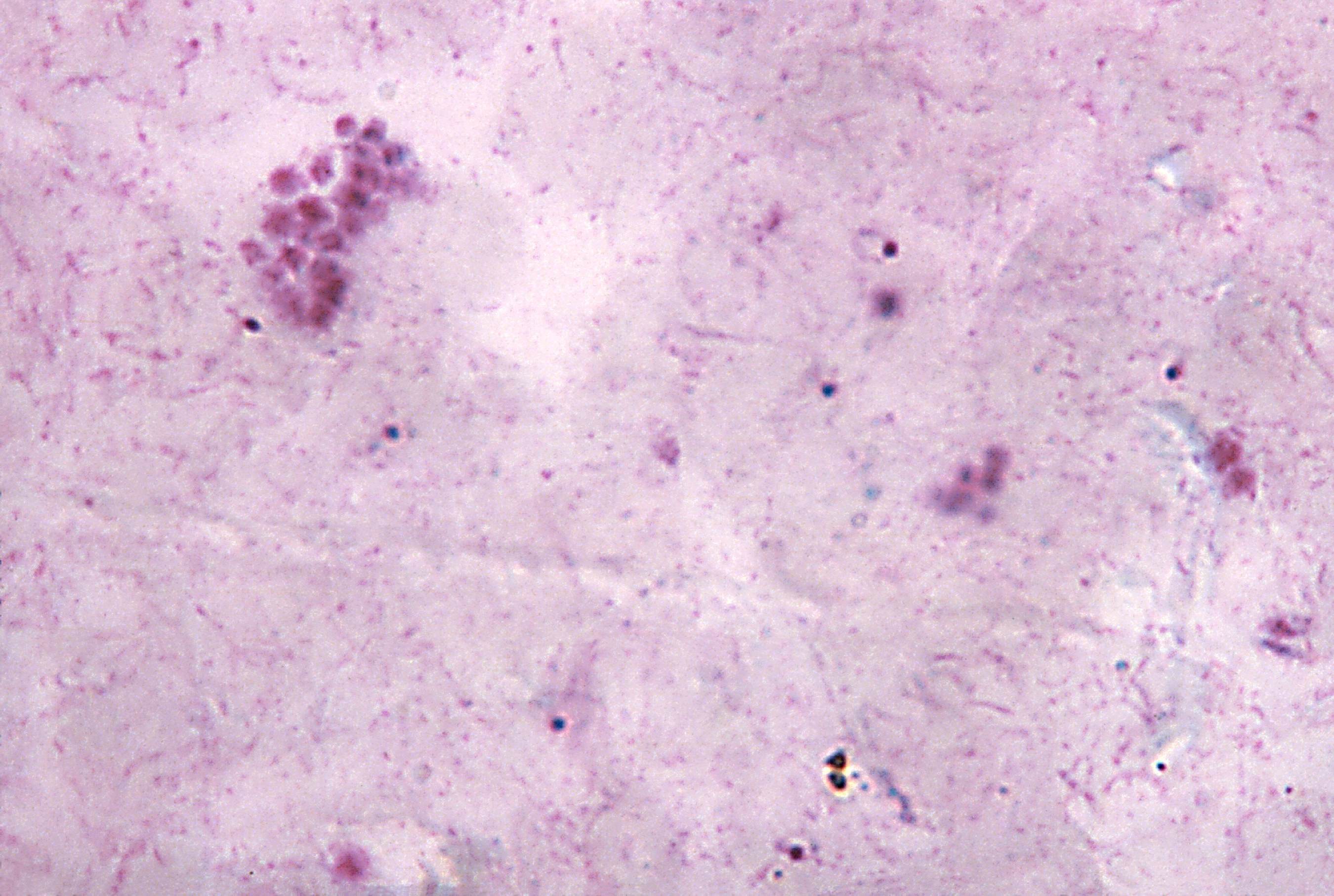 Многочисленные мелкие тельца. Цитоплазма микрофотография. Цитоплазма под микроскопом. Плазмодиум микроскопия. Вакуолизация цитоплазмы.