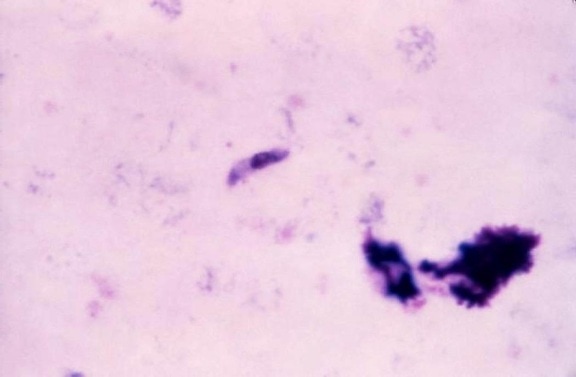mikroskop-bilde, nærvær, moden, falciparum, gametocyte