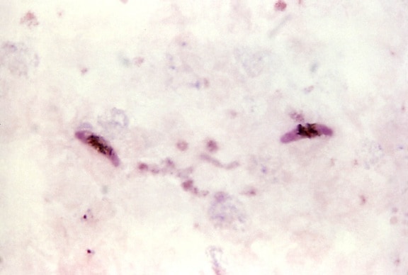 mikroskopische Aufnahme, zwei, längliche, Plasmodium falciparum, gametocytes, rötlichen, Zytoplasma