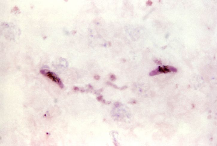 opname, twee langwerpige, plasmodium falciparum, gametocytes, roze, cytoplasma