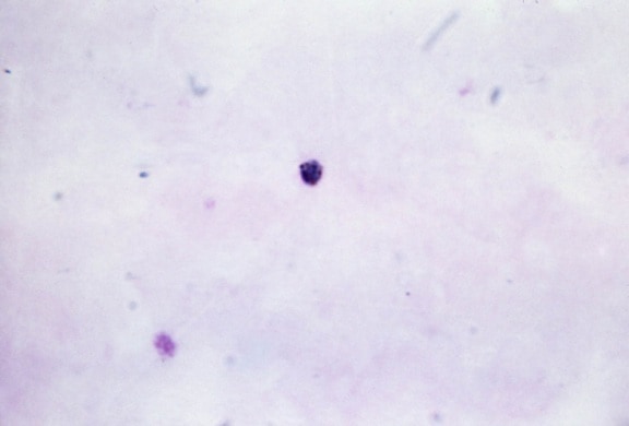micrograph, osoittaa, gametocyte, kypsä, kasvaa, plasmodium malariae trophozoite