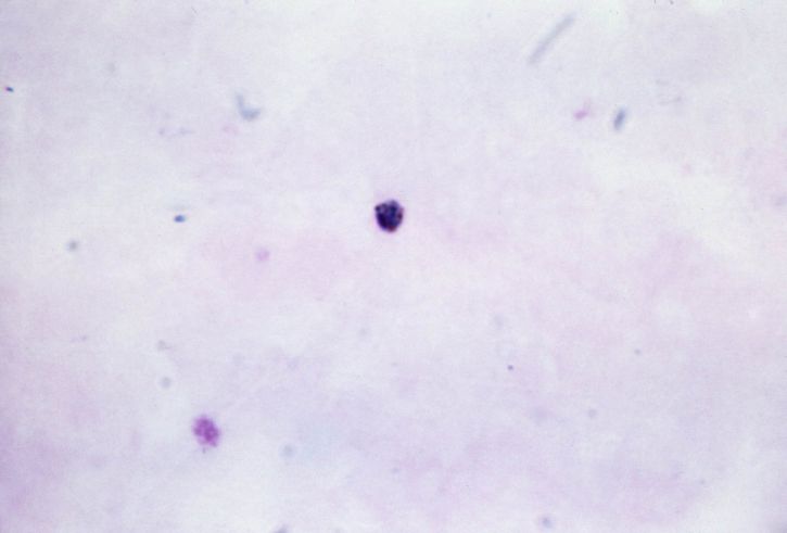 mikroskop-bilde, viser, gametocyte, eldre, vokser, plasmodium malariae, trophozoite