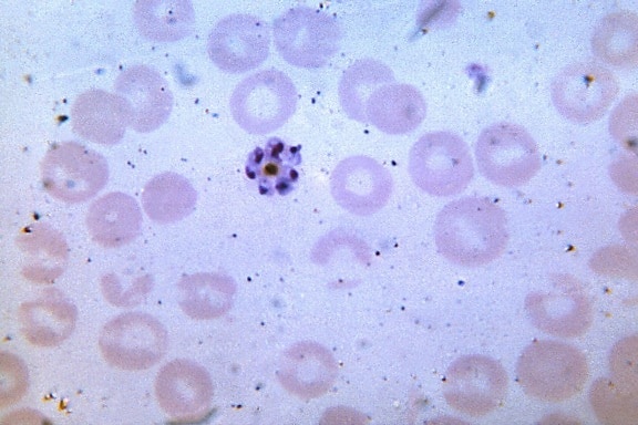 micrograph, shows, mature, malariae, schizont, merozoites, invisible, cytoplasm