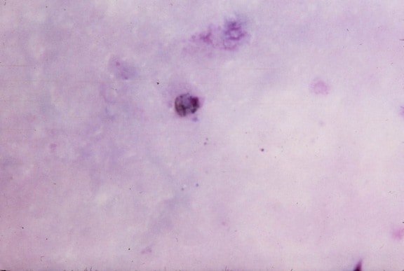 mikroskopische Aufnahme, zeigt, reif, ovale, trophozoite, offensichtlich, Licht, Zytoplasma, Pigment, Punktierung