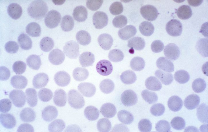 mikroskop-bilde, viser, ring, form, plasmodium falciparum, trophozoite, skjerm, maurers, kløfter