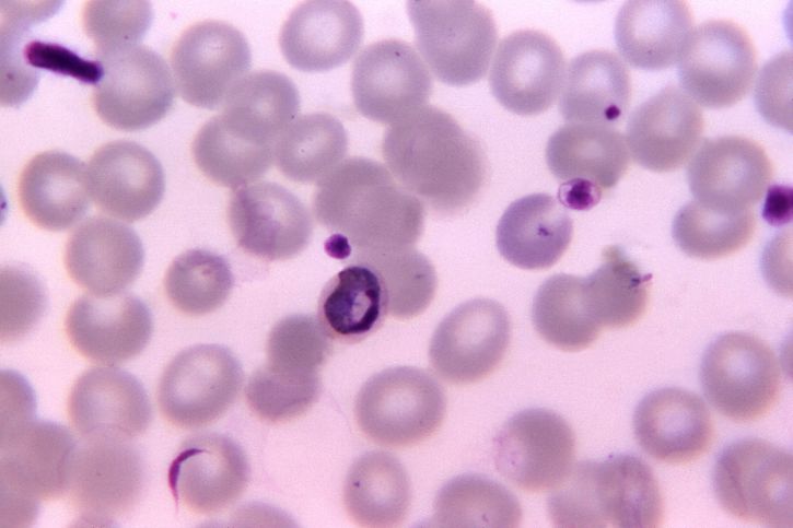 micrograph, cho thấy, cũ, phát triển, plasmodium malariae, trophozoite, vết, phóng đại, 1125 x