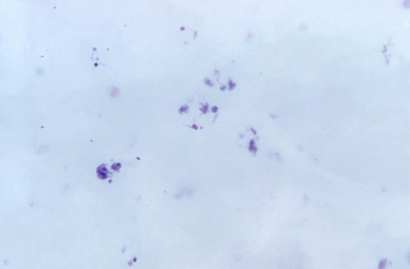 mikroskopische Aufnahme, zeigt, wachsen, vivax, Trophozoiten, schuffners, punkte, Fleck, mag, 1125x