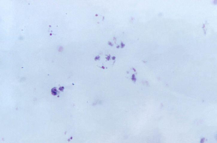 micrograph, shows, growing, vivax, trophozoites, schuffners, dots, stain, mag, 1125x