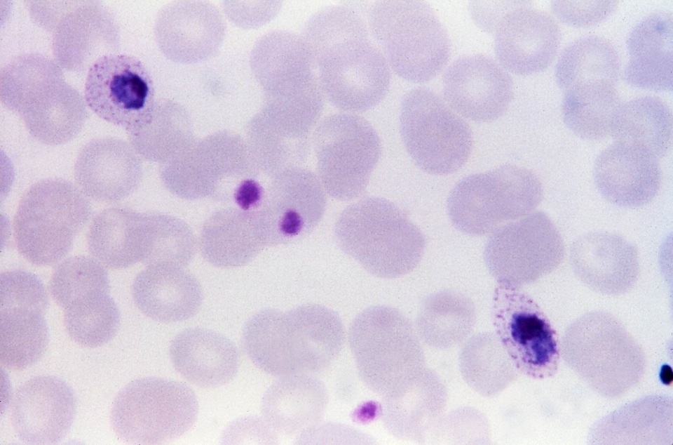 Free picture: blood smear, micrograph, plasmodium falciparum, parasite ...