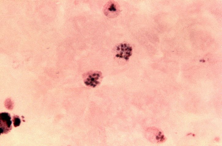 micrograph, osoittaa, kaksi, aikuinen plasmodium vivax, schizonts, merozoites
