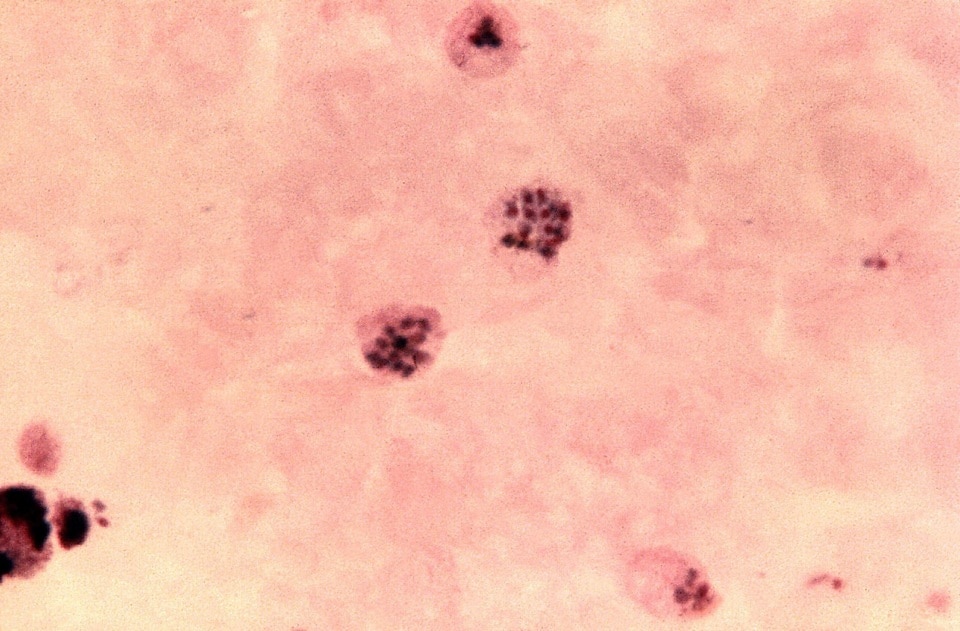 Kostenlose Bild Mikroskopische Aufnahme Shows Zwei Reif Plasmodium Vivax Schizonten